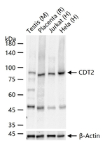 DTL Antibody in Western Blot (WB)