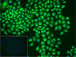 TUBB1 Recombinant Rabbit Monoclonal Antibody (10D13)