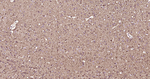 TUBB1 Antibody in Immunohistochemistry (Paraffin) (IHC (P))