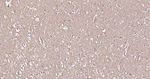 TUBB1 Antibody in Immunohistochemistry (Paraffin) (IHC (P))