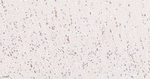 GRK3 Antibody in Immunohistochemistry (Paraffin) (IHC (P))