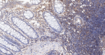GRK3 Antibody in Immunohistochemistry (Paraffin) (IHC (P))