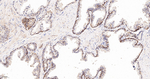 GRK3 Recombinant Rabbit Monoclonal Antibody (2B3)