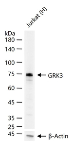 GRK3 Antibody in Western Blot (WB)