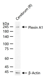 Plexin-A1 Recombinant Rabbit Monoclonal Antibody (8C6)