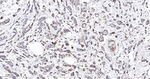 IGFBP2 Antibody in Immunohistochemistry (Paraffin) (IHC (P))