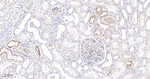 IGFBP2 Antibody in Immunohistochemistry (Paraffin) (IHC (P))