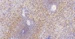IKK epsilon Antibody in Immunohistochemistry (Paraffin) (IHC (P))