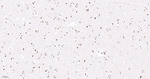 ADAR1 Antibody in Immunohistochemistry (Paraffin) (IHC (P))