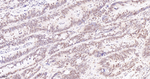 ADAR1 Antibody in Immunohistochemistry (Paraffin) (IHC (P))