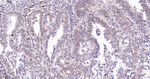 ADAR1 Recombinant Rabbit Monoclonal Antibody (9A11)