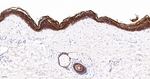 PERP Antibody in Immunohistochemistry (Paraffin) (IHC (P))