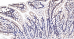 BAF53A Recombinant Rabbit Monoclonal Antibody (9F11)