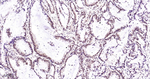 NuMA Antibody in Immunohistochemistry (Paraffin) (IHC (P))