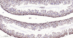 NuMA Antibody in Immunohistochemistry (Paraffin) (IHC (P))