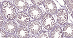 NuMA Antibody in Immunohistochemistry (Paraffin) (IHC (P))