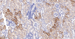 IGFBP7 Recombinant Rabbit Monoclonal Antibody (12A15)