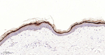 LOR Antibody in Immunohistochemistry (Paraffin) (IHC (P))