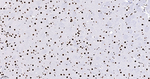 SFPQ Antibody in Immunohistochemistry (Paraffin) (IHC (P))