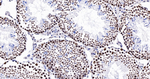 SFPQ Antibody in Immunohistochemistry (Paraffin) (IHC (P))