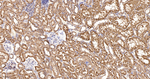 Cytochrome P450 Reductase Antibody in Immunohistochemistry (Paraffin) (IHC (P))