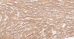 Cytochrome P450 Reductase Antibody in Immunohistochemistry (Paraffin) (IHC (P))
