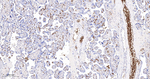 GYPC Recombinant Rabbit Monoclonal Antibody (1H4)