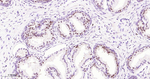 Nkx3.1 Antibody in Immunohistochemistry (Paraffin) (IHC (P))