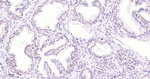 Nkx3.1 Recombinant Rabbit Monoclonal Antibody (5D10)