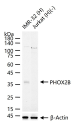 PHOX2B Recombinant Rabbit Monoclonal Antibody (9A2)
