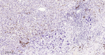 Tartrate Resistant Acid Phosphatase Recombinant Rabbit Monoclonal Antibody (2D12)