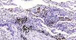 Tartrate Resistant Acid Phosphatase Antibody in Immunohistochemistry (Paraffin) (IHC (P))