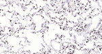 NAPSA Antibody in Immunohistochemistry (Paraffin) (IHC (P))