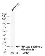 MSMB Antibody in Western Blot (WB)