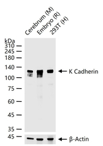 K-cadherin Antibody in Western Blot (WB)