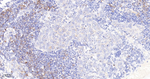 RRM1 Antibody in Immunohistochemistry (Paraffin) (IHC (P))