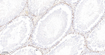 RRM1 Antibody in Immunohistochemistry (Paraffin) (IHC (P))
