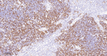 RRM1 Antibody in Immunohistochemistry (Paraffin) (IHC (P))
