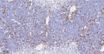 RRM1 Antibody in Immunohistochemistry (Paraffin) (IHC (P))