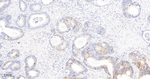 RRM1 Antibody in Immunohistochemistry (Paraffin) (IHC (P))