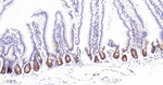RRM1 Antibody in Immunohistochemistry (Paraffin) (IHC (P))