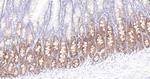 RRM1 Antibody in Immunohistochemistry (Paraffin) (IHC (P))