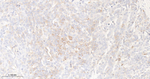 RRM1 Antibody in Immunohistochemistry (Paraffin) (IHC (P))
