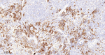 RRM1 Antibody in Immunohistochemistry (Paraffin) (IHC (P))
