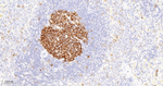 RRM1 Antibody in Immunohistochemistry (Paraffin) (IHC (P))