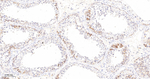 RRM1 Antibody in Immunohistochemistry (Paraffin) (IHC (P))