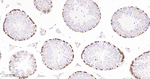RRM1 Antibody in Immunohistochemistry (Paraffin) (IHC (P))