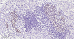 IMP3 Antibody in Immunohistochemistry (Paraffin) (IHC (P))