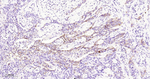 IMP3 Antibody in Immunohistochemistry (Paraffin) (IHC (P))