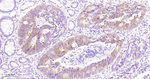 IMP3 Antibody in Immunohistochemistry (Paraffin) (IHC (P))